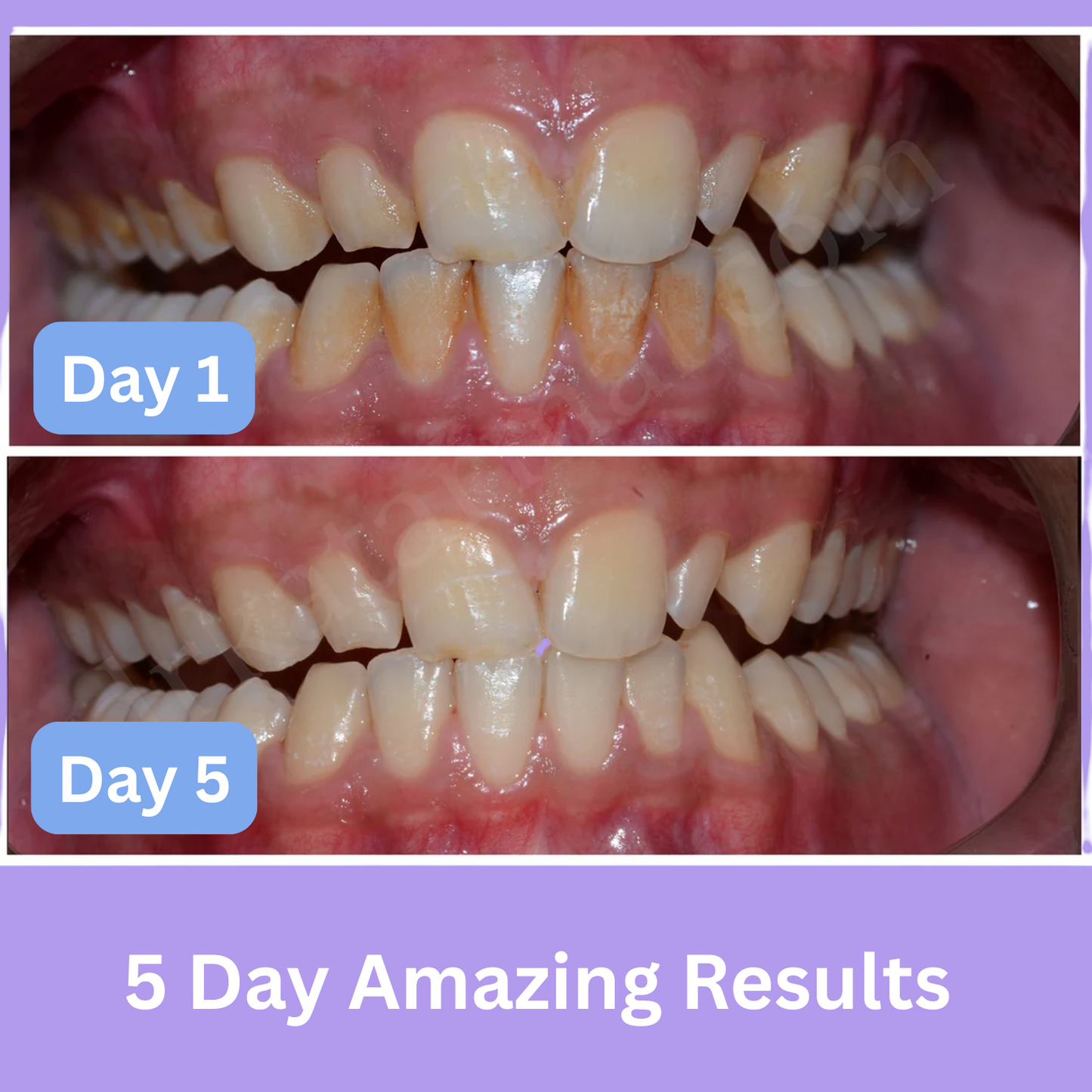 MARVIS® Ultra Whitening Mint Toothpaste